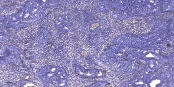 SCML2 rabbit pAb Antibody