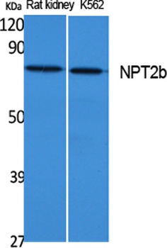 NPT2b rabbit pAb