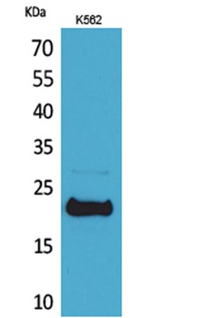 LIF rabbit pAb Antibody