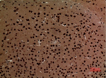 K-cadherin rabbit pAb Antibody