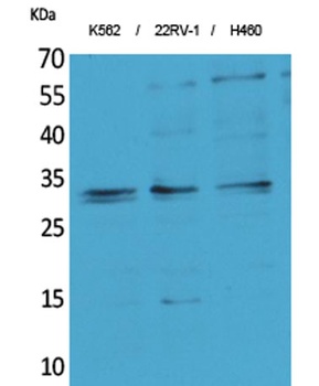 SCP-3 rabbit pAb Antibody