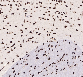 KLF12 rabbit pAb Antibody