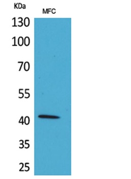 α-SMA rabbit pAb Antibody