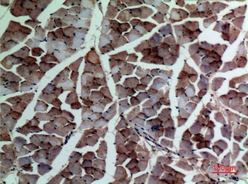 α-SMA rabbit pAb Antibody