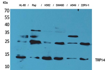 TRP14 rabbit pAb Antibody