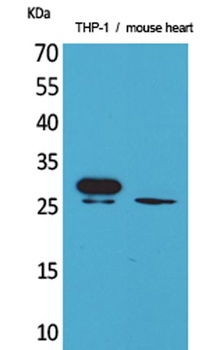 TREM-1 rabbit pAb Antibody
