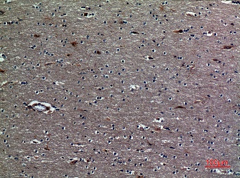 TREM-1 rabbit pAb Antibody