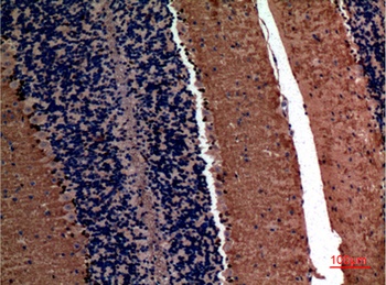 AFP rabbit pAb Antibody