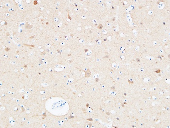 UCH-L1 rabbit pAb Antibody