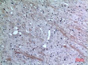 Eotaxin-3 rabbit pAb