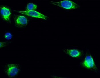 IL-8 rabbit pAb Antibody