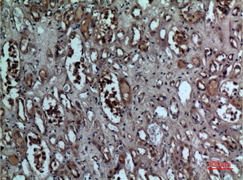 BNIP-3 rabbit pAb Antibody