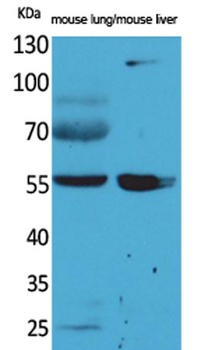 ALDH1A1 rabbit pAb Antibody