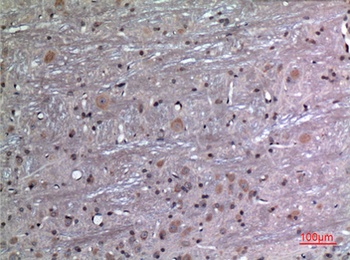 FGF-12 rabbit pAb Antibody
