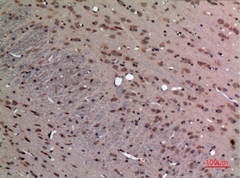 FGF-12 rabbit pAb Antibody