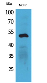 Cytokeratin 14 rabbit pAb Antibody