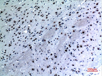Cytokeratin 14 rabbit pAb Antibody