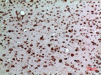 MK rabbit pAb Antibody