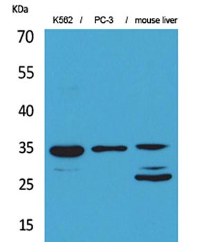Cdc34 rabbit pAb Antibody