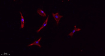 CD133 rabbit pAb Antibody