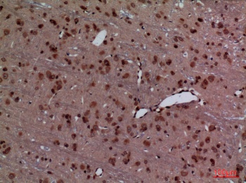 HoxD3 rabbit pAb Antibody