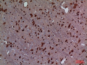 HoxD3 rabbit pAb Antibody