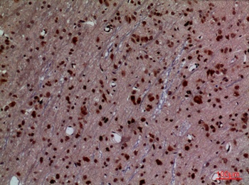 HoxD3 rabbit pAb Antibody