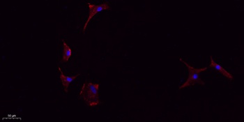 IL-1β rabbit pAb Antibody