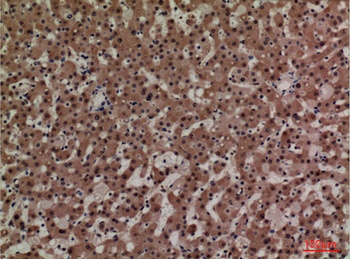 ADM rabbit pAb Antibody
