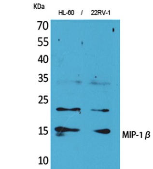 MIP-1β rabbit pAb Antibody