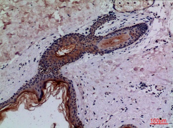 CD68 rabbit pAb Antibody