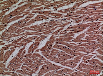 P2X3 rabbit pAb Antibody