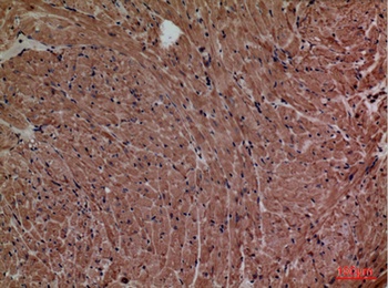 P2X3 rabbit pAb Antibody