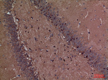 Fascin 1 rabbit pAb Antibody