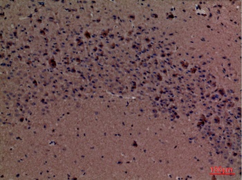 Fascin 1 rabbit pAb Antibody