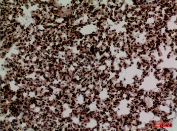 FOXP1 rabbit pAb Antibody