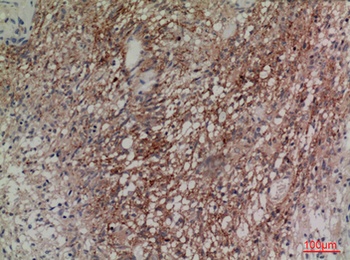 Neuregulin-2 rabbit pAb