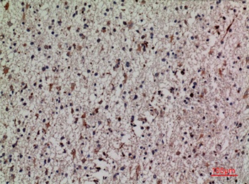 Keap-1 rabbit pAb Antibody