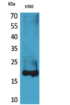 Lipocalin-1 rabbit pAb Antibody