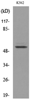 Protein C rabbit pAb Antibody