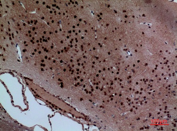 Layilin rabbit pAb Antibody