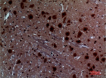 Layilin rabbit pAb Antibody