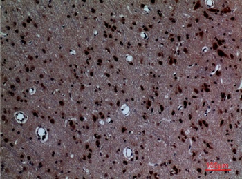 Layilin rabbit pAb Antibody