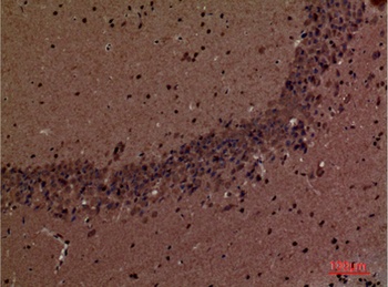 SHIP-2 rabbit pAb Antibody