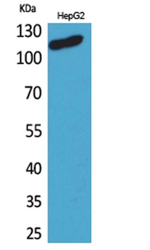 DPYD rabbit pAb Antibody