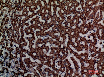 DCI rabbit pAb Antibody