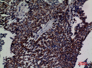 DCI rabbit pAb Antibody