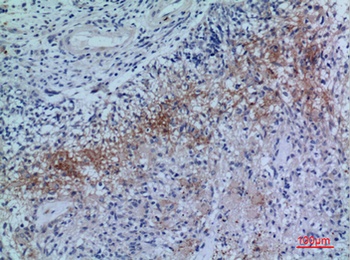 Neuropilin-2 rabbit pAb Antibody