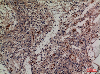 SNAP 23 rabbit pAb Antibody