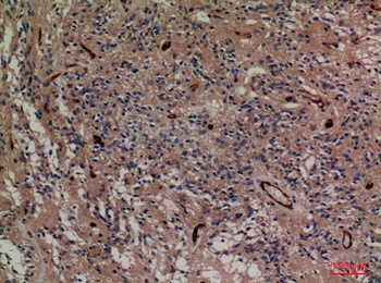 SNAP 23 rabbit pAb Antibody